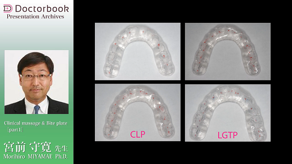 Occlusionの真髄～色々な咬合と機能～ | Doctorbook academy (ドクター